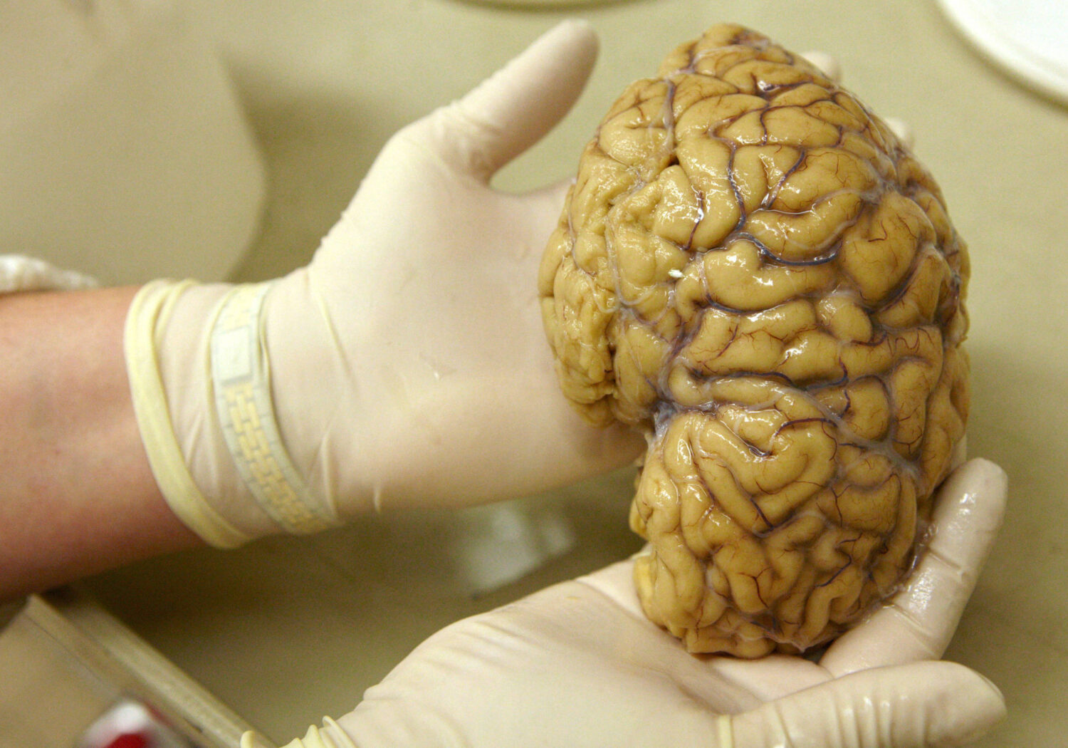 Cientistas mapeiam atividade no córtex pré-frontal do cérebro, área que controla emoções