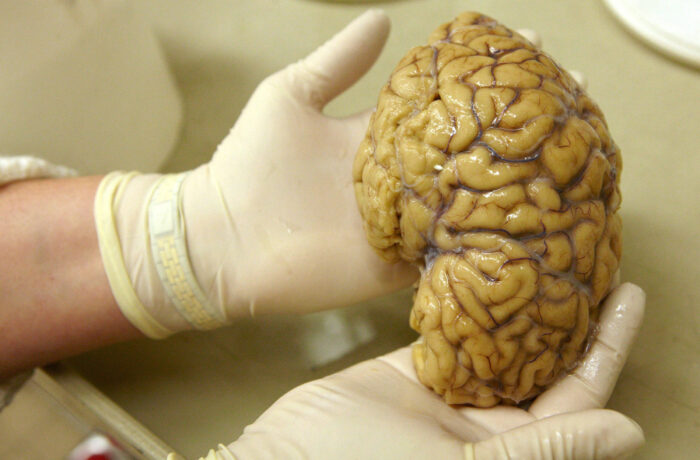 Cientistas mapeiam atividade no córtex pré-frontal do cérebro, área que controla emoções